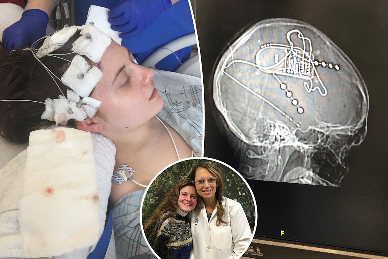 My 'panic attacks' became so severe - I needed brain surgery at 24 to fix them.