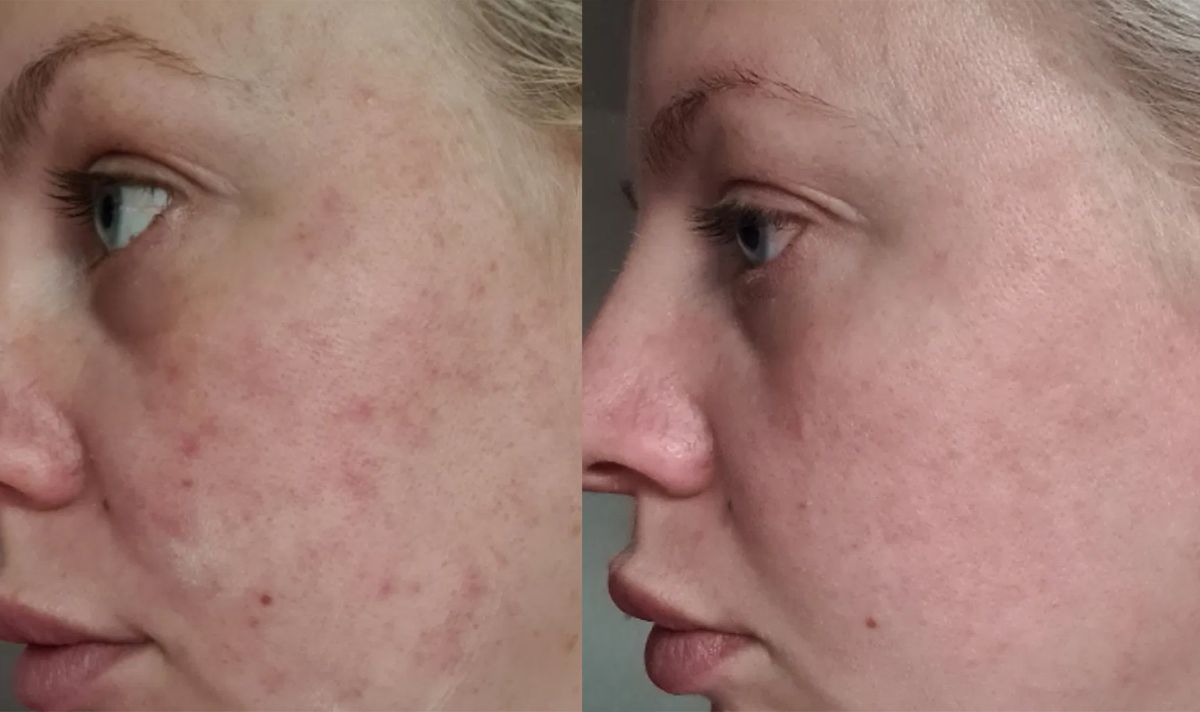 Users shared their results using Reverse Life