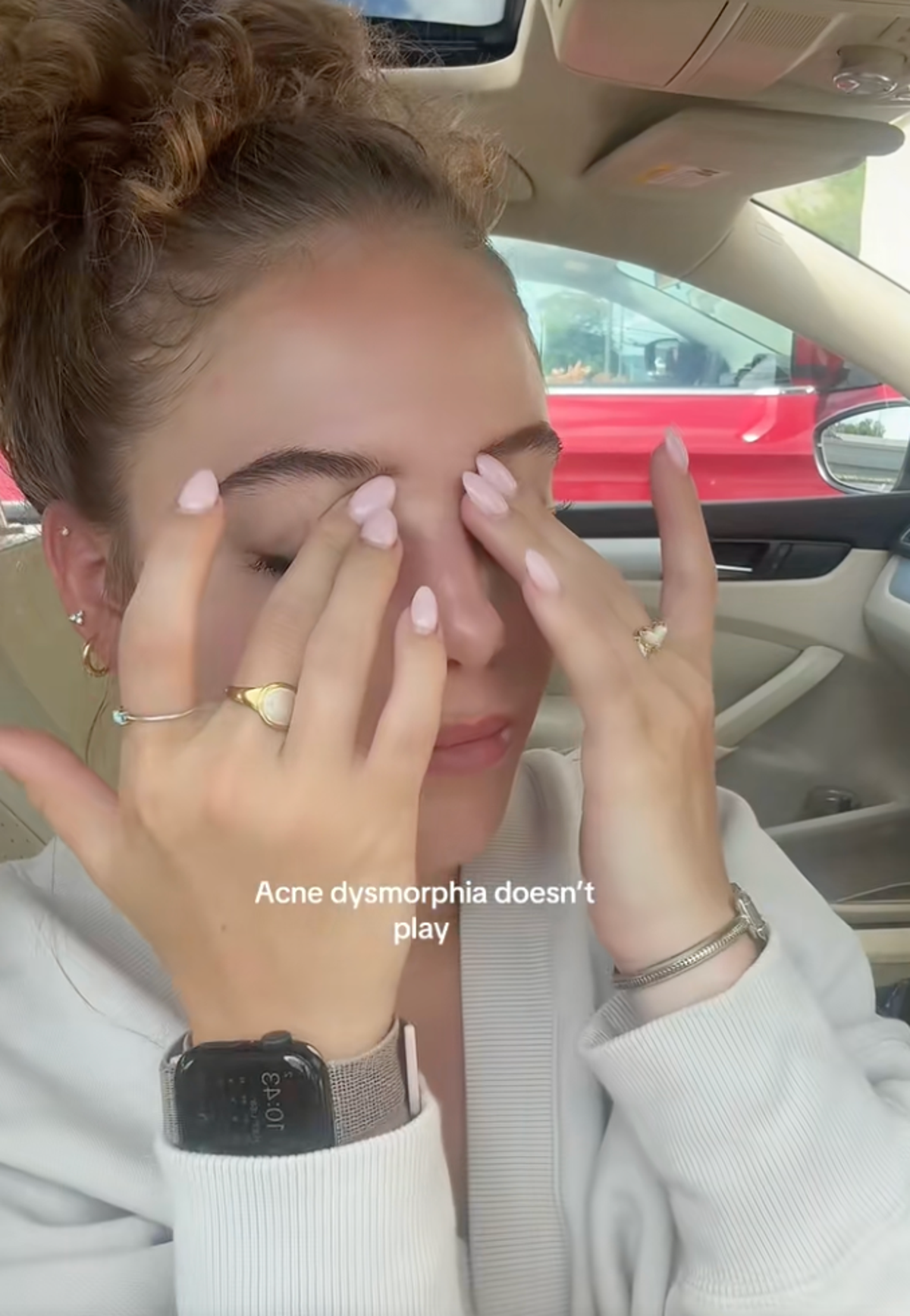 Maddie Ogle shares her experience with skin dysmorphia on TikTok (TikTok/@maddieogle10)